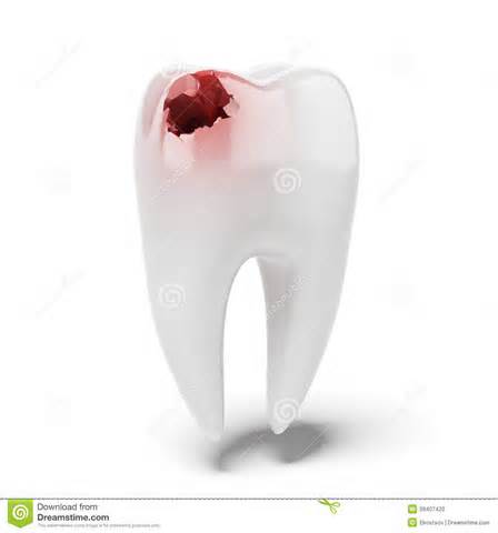 définition de aching