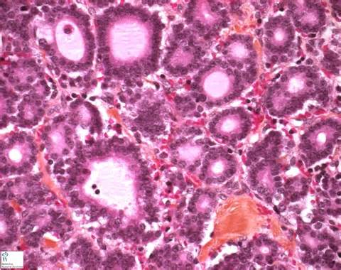 definisyon nan acinar