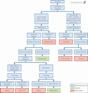 definisyon nan algorithm