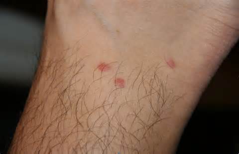 Definició de lesions