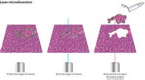 definisyon nan microdissection