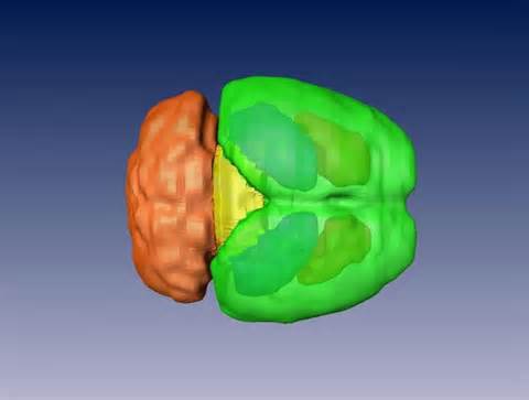 Definice midbrains