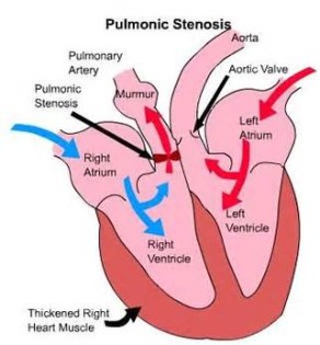 Ορισμός του pulmonic