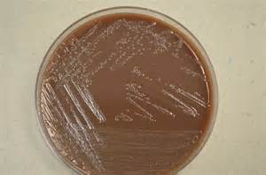 opredelitev aerosolize