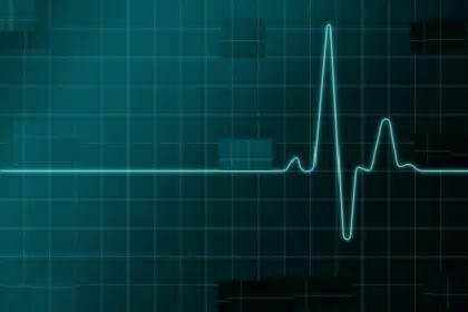 Definice cardiogram