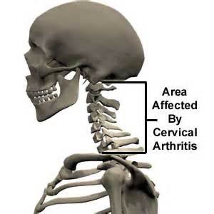 Definiția cervical