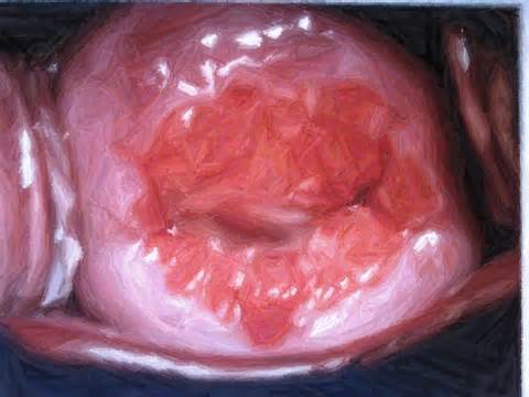 diffiniad o cervix