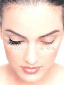 opredelitev lashed