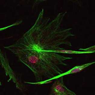 definisyon nan microscopy