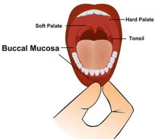 definisyon nan mucosas