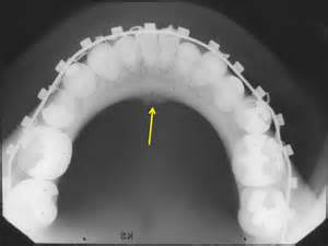 Definice occlusal