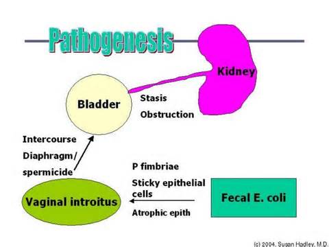 pathogeneses परिभाषा