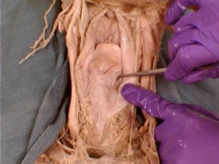 Mõiste piriform