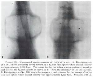 Definitions of roentgenograms