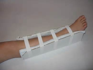 Definicja splints