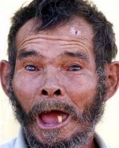 Definició de ugliest
