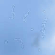 definisyon nan floaters