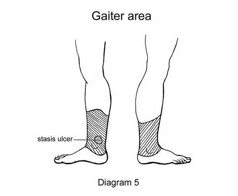 definizzjoni ta gaiter