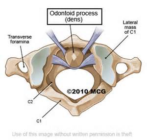 odontoid 定義