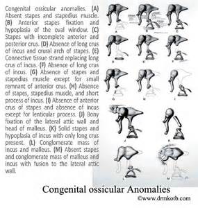 визначення ossicular