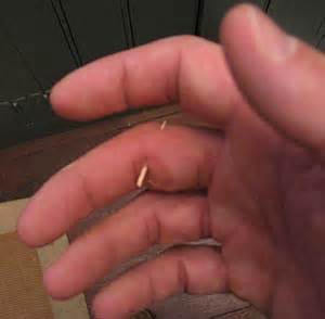 definizzjoni ta splinters