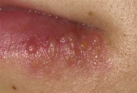 Definitions of std