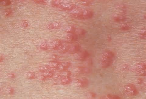 Definitions of std