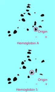 definisyon nan hemoglobins