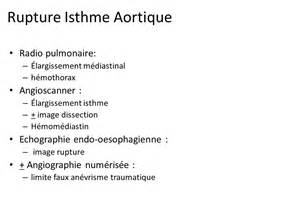 diffiniad o incurvations