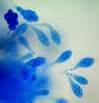 Definice phycomycetous